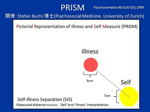 PRISM（Pictorial Representaion of Illness and Self Measure） イメージ